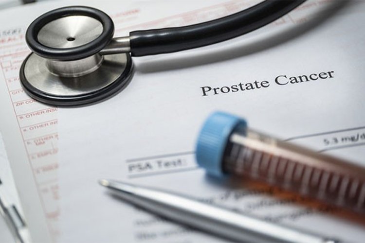 A new standard of care for rising PSA levels after prostate cancer treatment