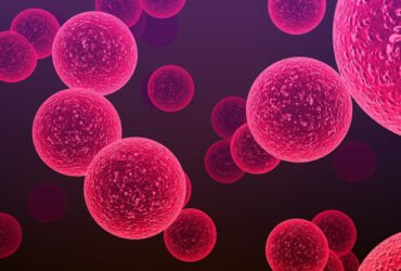 Cellulitis: How Long Does It Take to Heal on Legs?