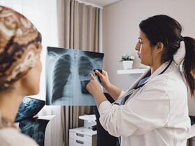 New guidelines aim to screen millions more people for lung cancer