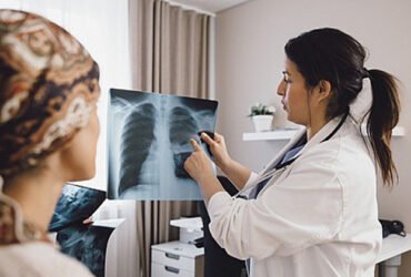 New guidelines aim to screen millions more people for lung cancer