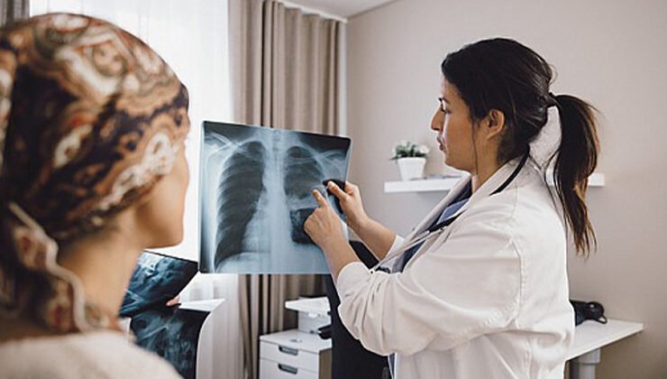 New guidelines aim to screen millions more people for lung cancer