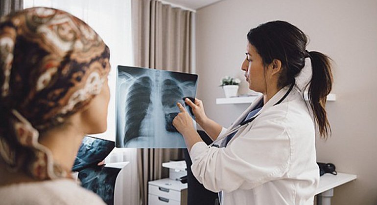 New guidelines aim to screen millions more people for lung cancer